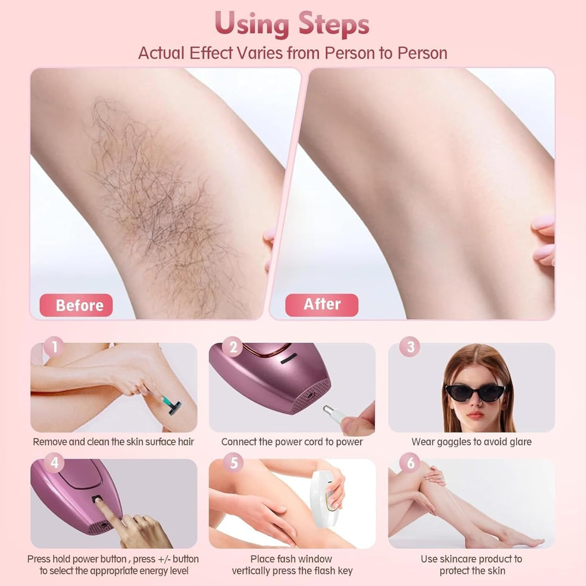 Mini Laser Hair Removal BRELZA