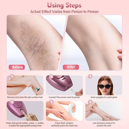 Mini Laser Hair Removal BRELZA