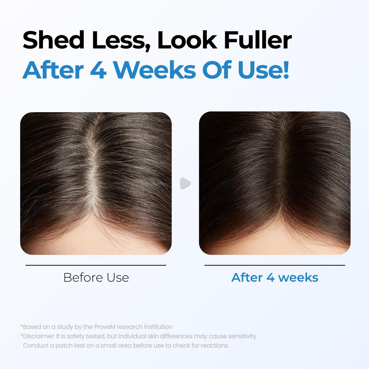 Scalpy Growth Serum - Hair Fall Solution