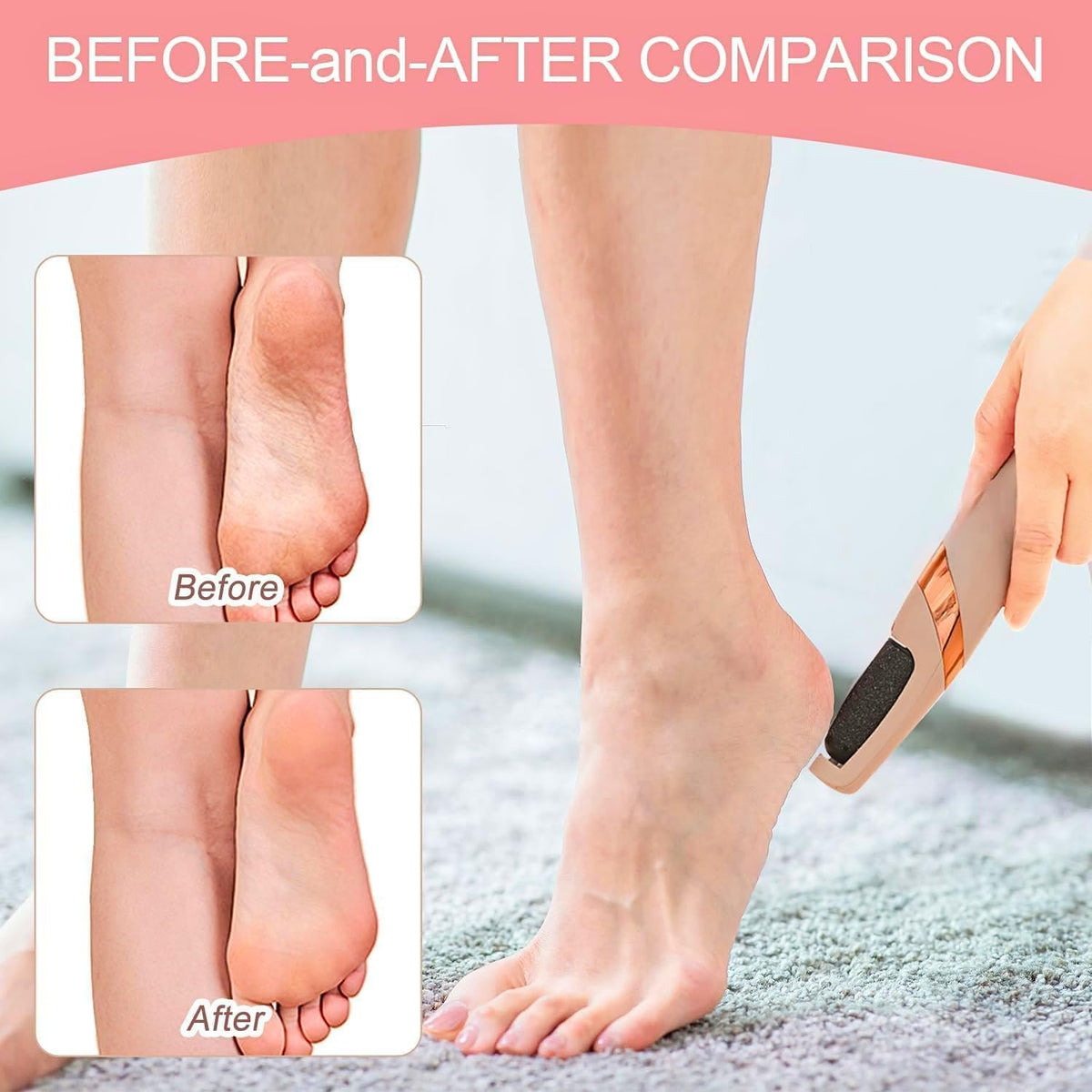 Electric Pedicure Foot File Callus Remover BRELZA
