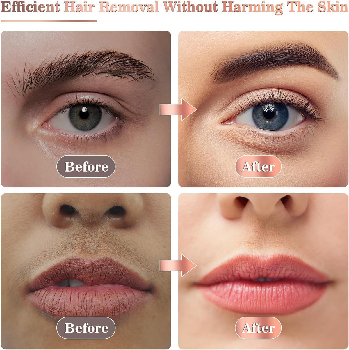 Facial Hair Remover BRELZA