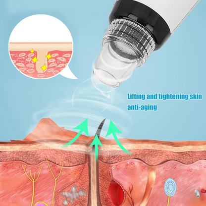 Electric Black Head Suction Instrument Face Cleaner
